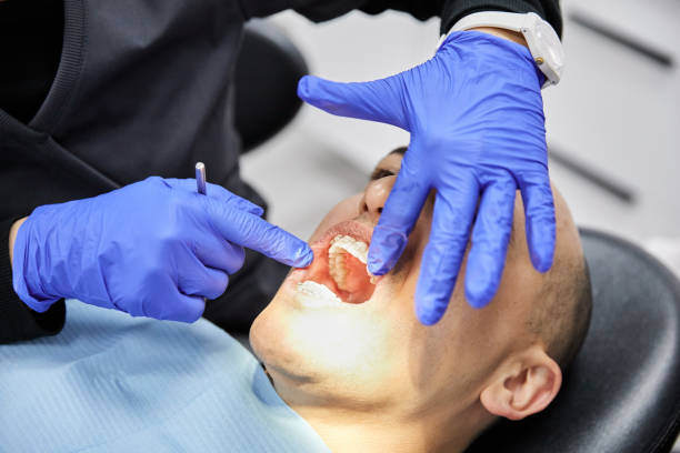 Best Emergency Wisdom Teeth Removal in Jackson, AL